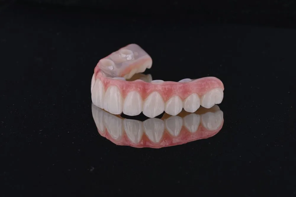 full arch dental implants top teeth from the side view