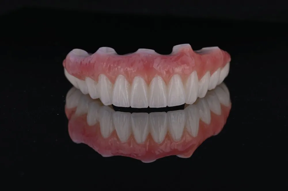 full arch dental implants bottom teeth straight on