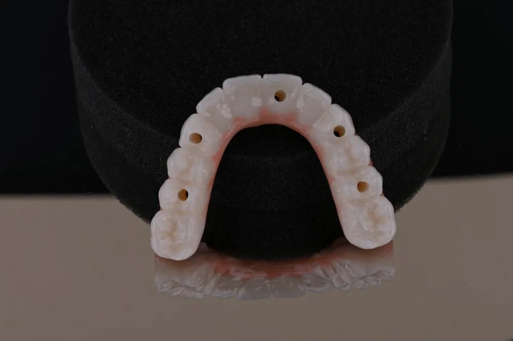 underside of full arch dental implants