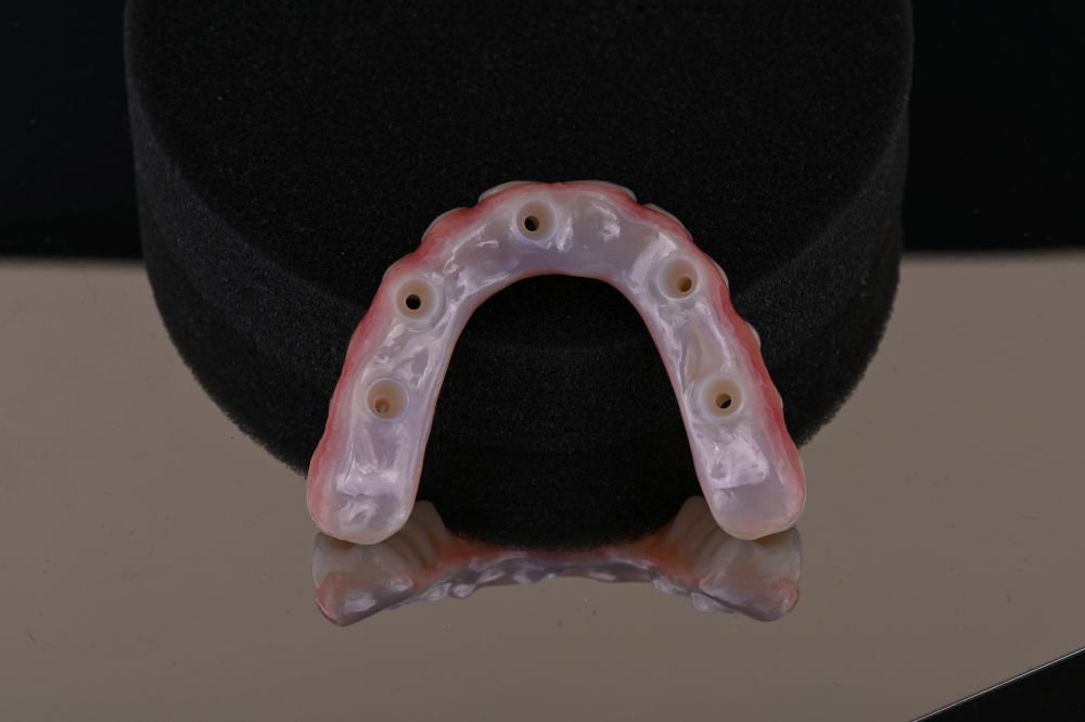 underside of full arch dental implants number 2
