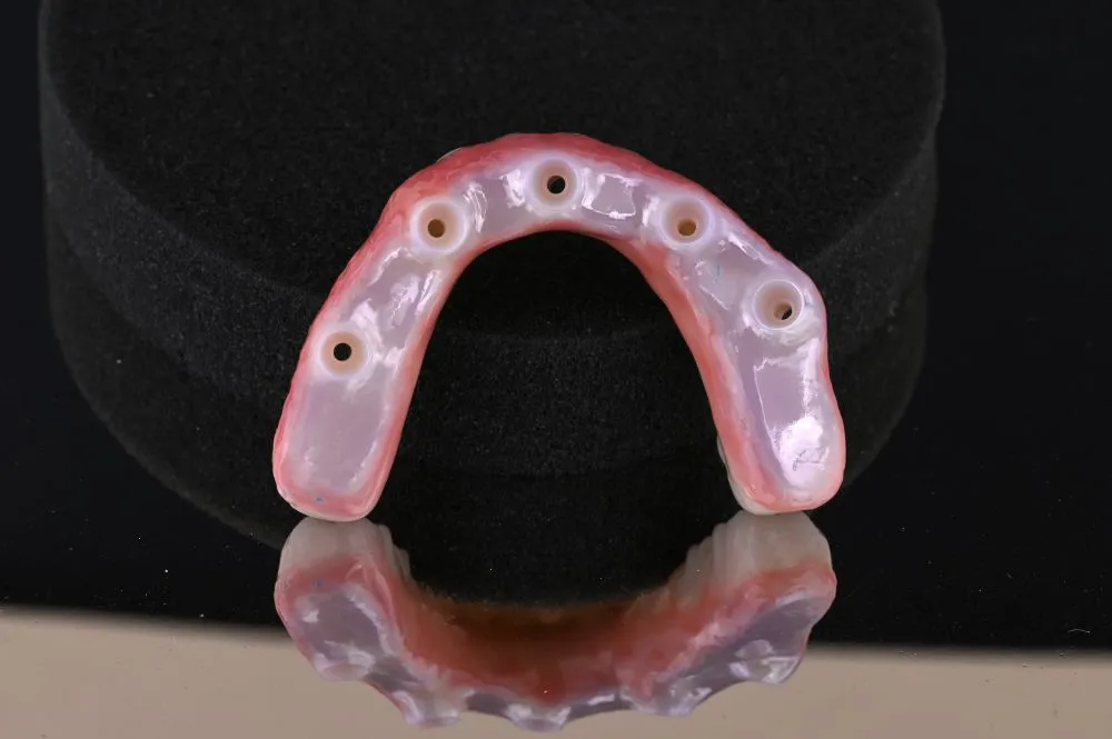 underside of full arch dental implants number 3