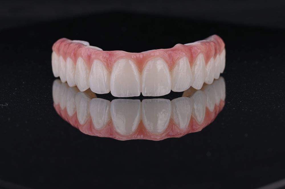 full arch dental implants top teeth straight on